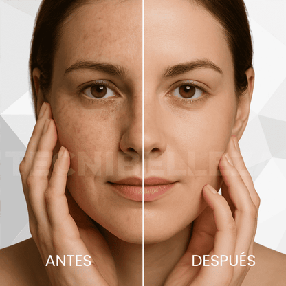 💆♀️ SkinGlowPro®PRADIOFRECUENCIA